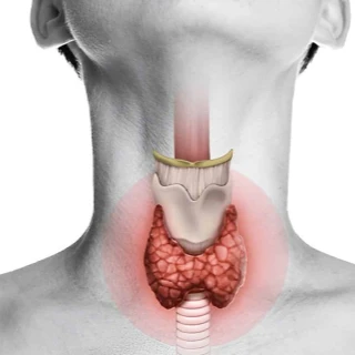 Thyroidectomy